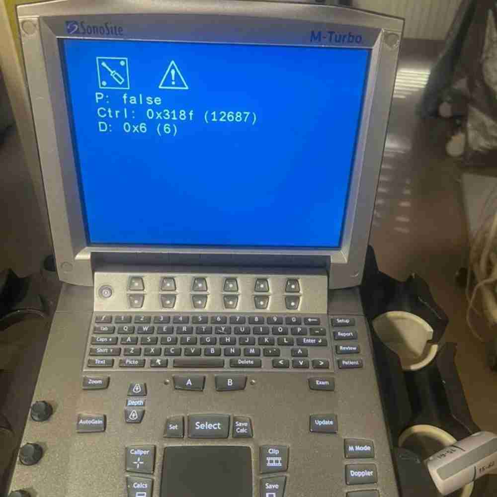 إصلاح متخصص لآلة تخطيط صدى القلب